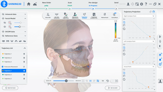 MetiSmile -Scanner facial Shining 3D