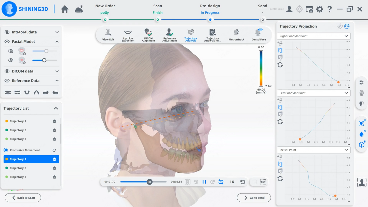 MetiSmile -Scanner facial Shining 3D
