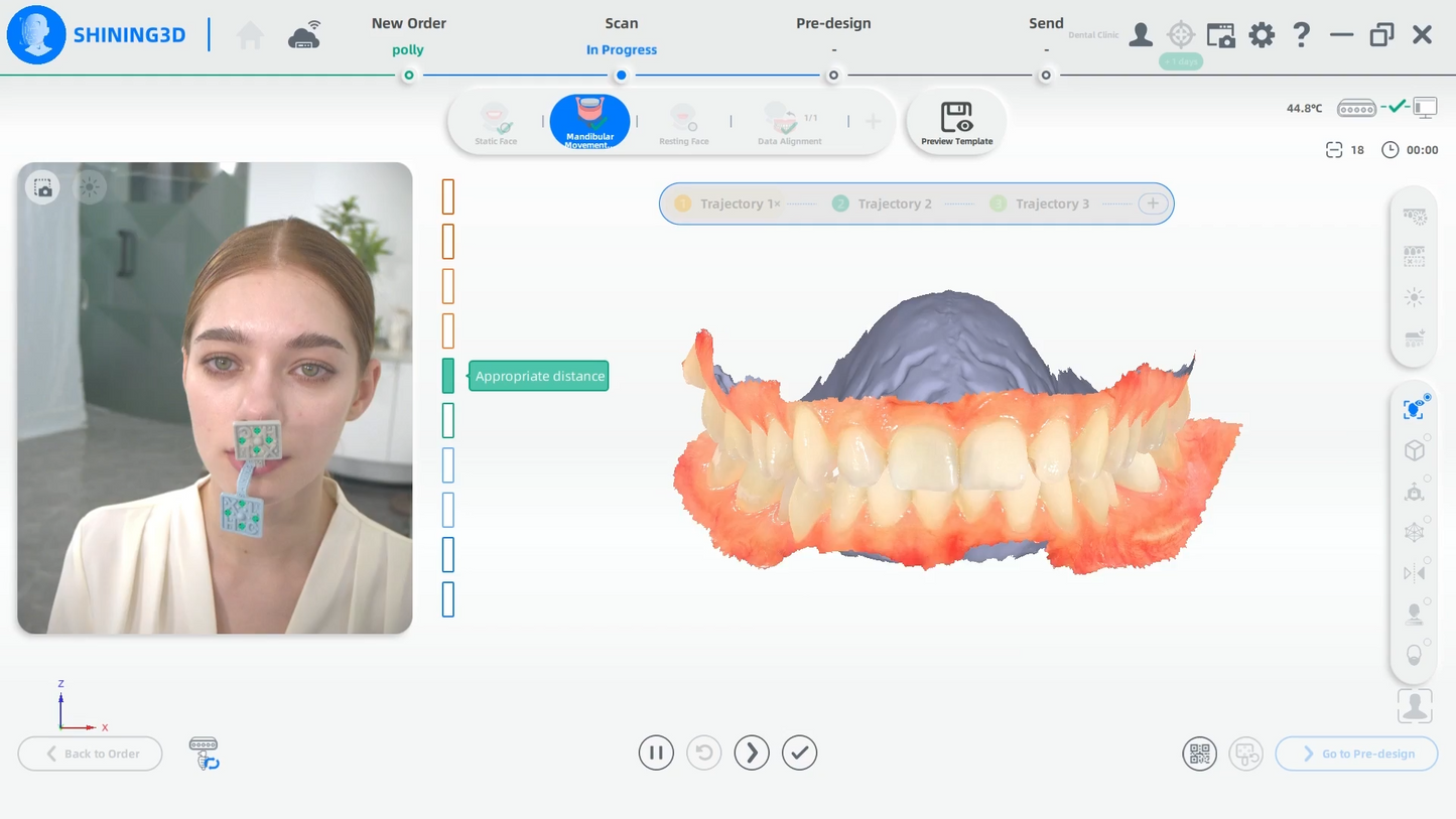 Scanner Facial !!!! MetiSmile-MR