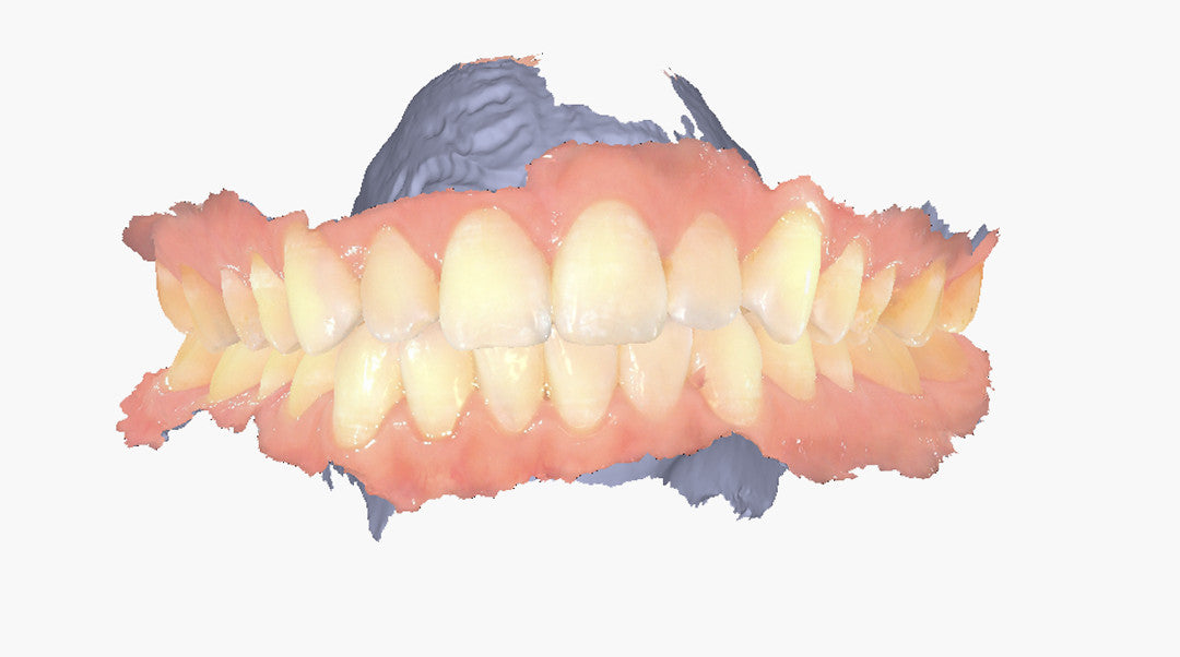 Scanner Intro oral - Aoralscan Elite -Shining 3D