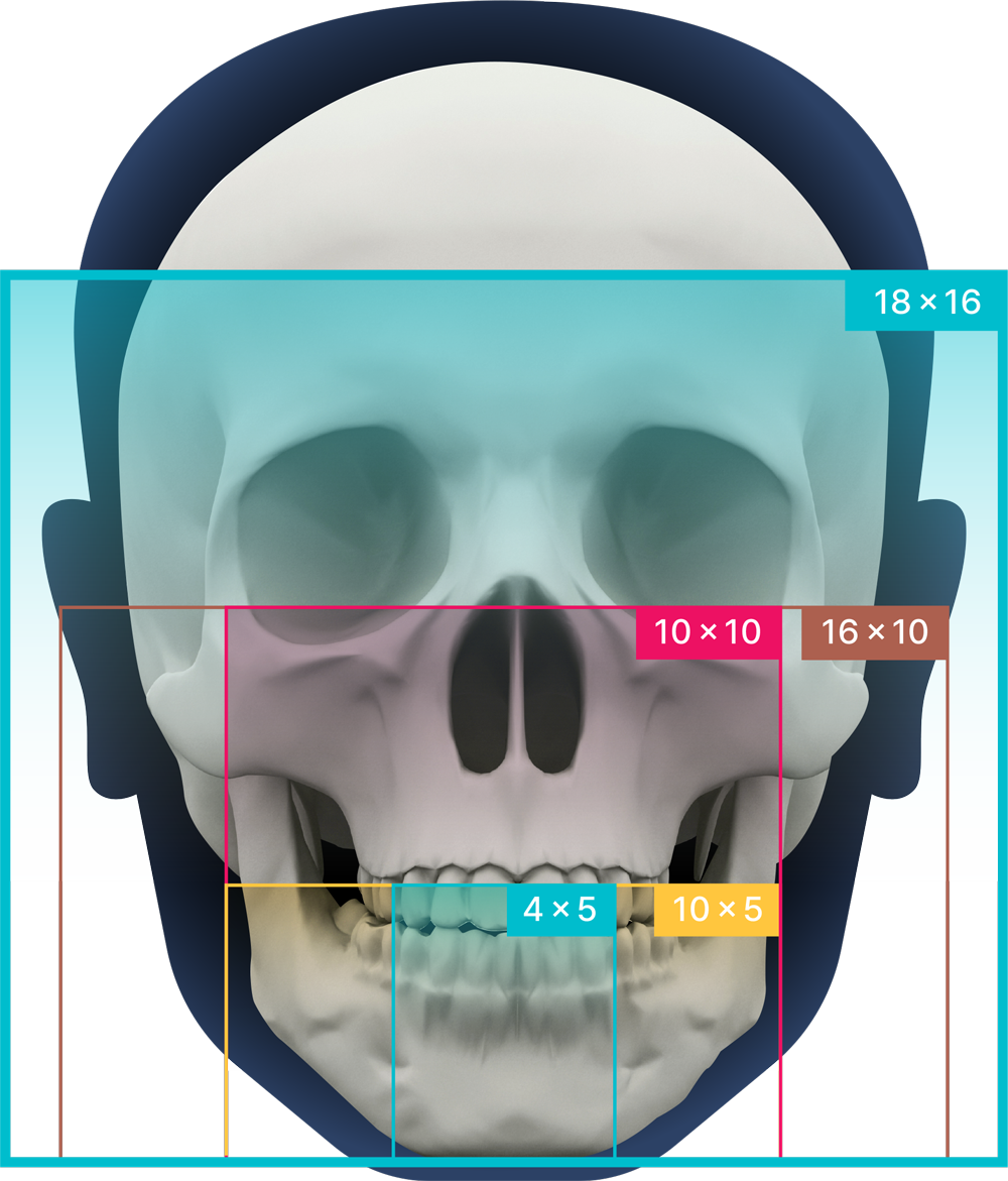Radiologie RAY Alpha Plus 160